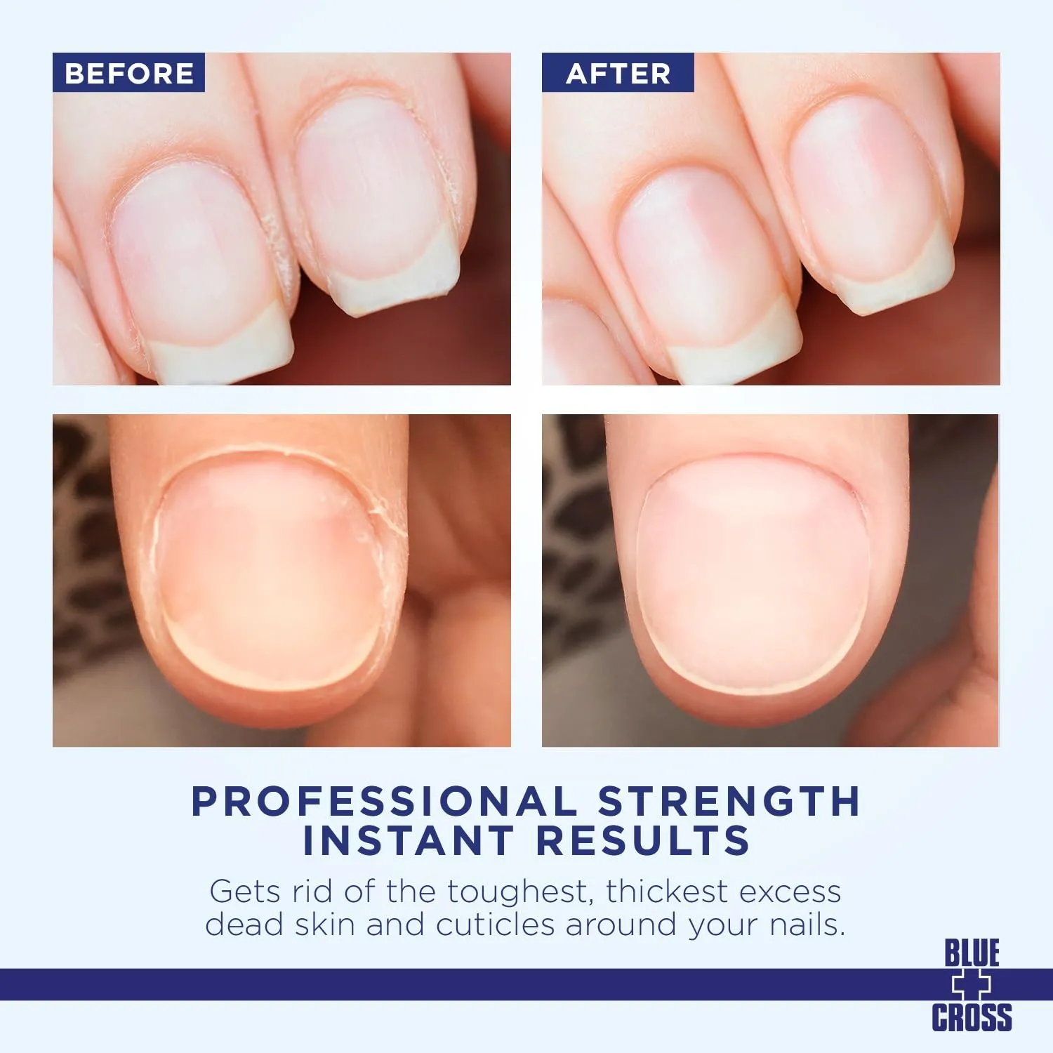 Blue Cross Hydrating, Moisturizing, Strengthening Cuticle Remover Oil with Lanolin   Extra Strength Callus Remover Gel for Heel or Feet, 6 oz each, 2 pack Bundle