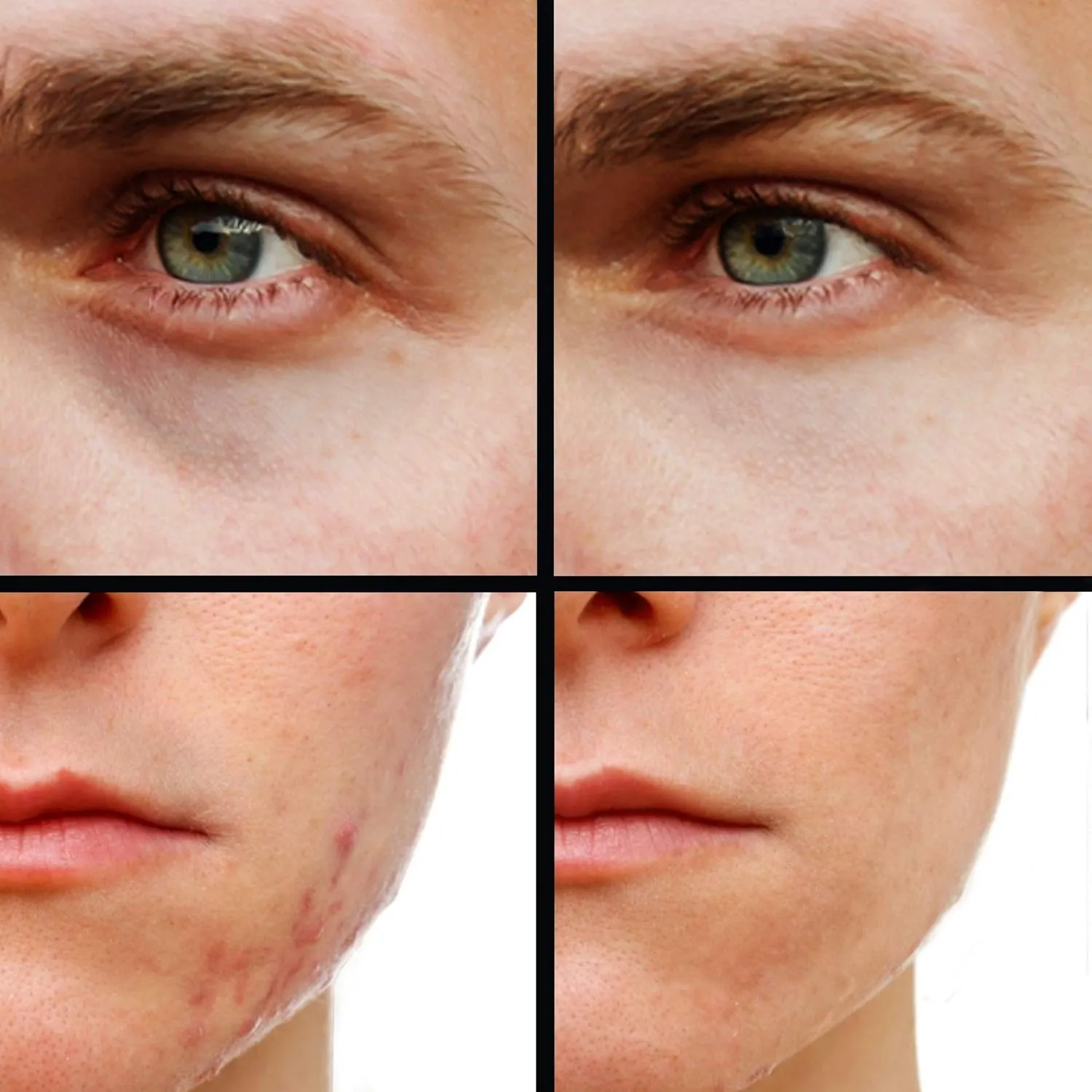 Concealer (Shade 2 of 6) Dark Circle Under Eye Cream Corrector, Multi-Use, Pimples, Scars, Rashes