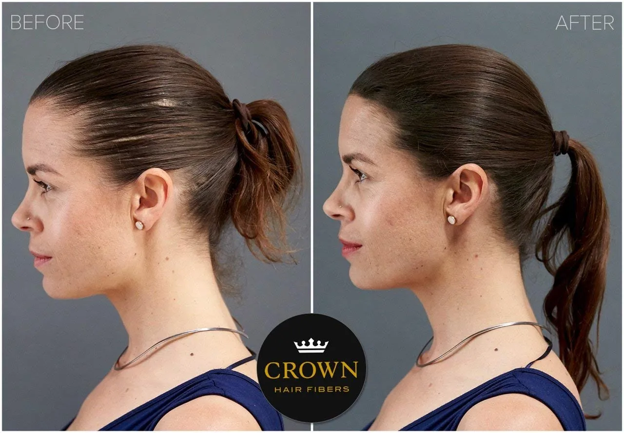 CROWN Hair Building Fibers (28g) - Instantly Cover Fine & Thinning Hair for a Thicker, Fuller Look - A Natural Keratin Concealer - 13 Shades for Men & Women - Black