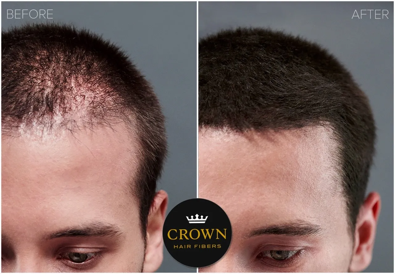 CROWN Hair Building Fibers (28g) - Instantly Cover Fine & Thinning Hair for a Thicker, Fuller Look - A Natural Keratin Concealer - 13 Shades for Men & Women - Black