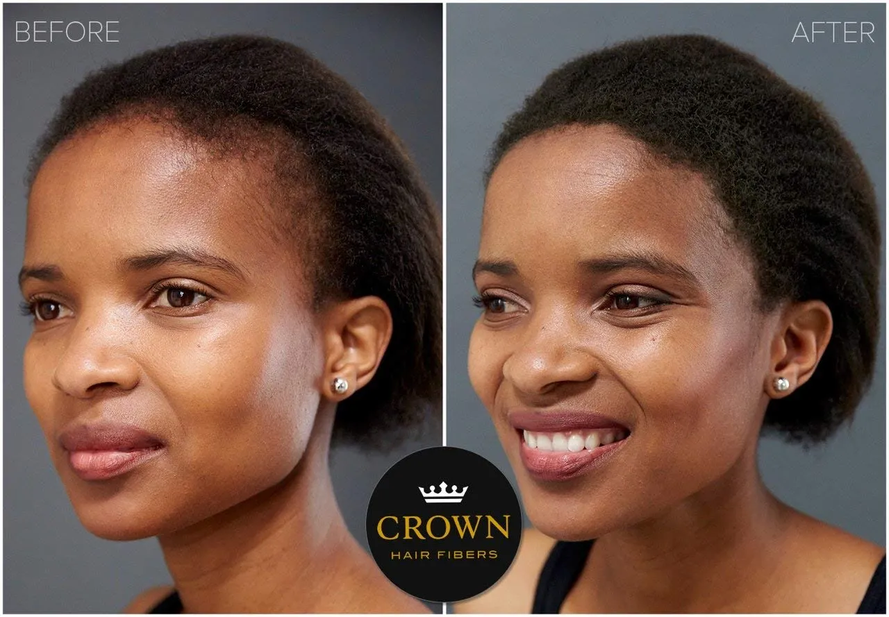 CROWN Hair Building Fibers (28g) - Instantly Cover Fine & Thinning Hair for a Thicker, Fuller Look - A Natural Keratin Concealer - 13 Shades for Men & Women - Black