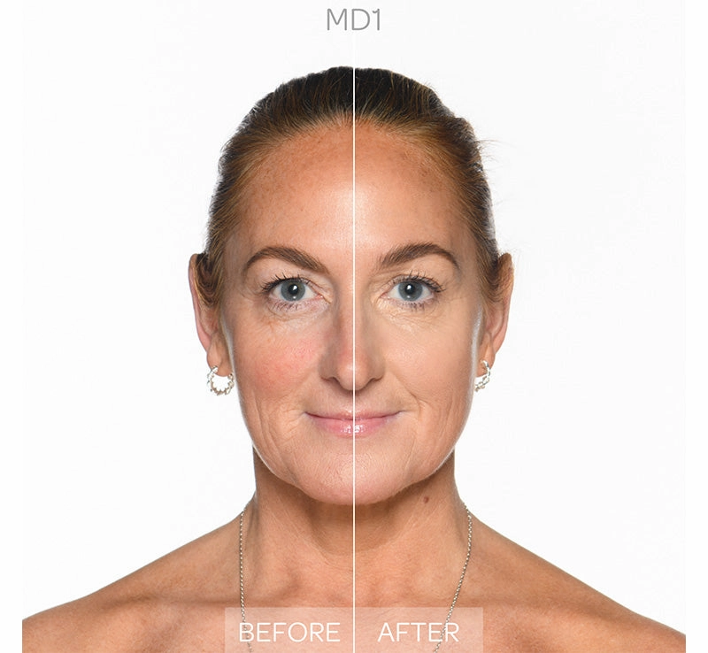 FULL IMPACT COMPLETE COVERAGE CONCEALER - MD1