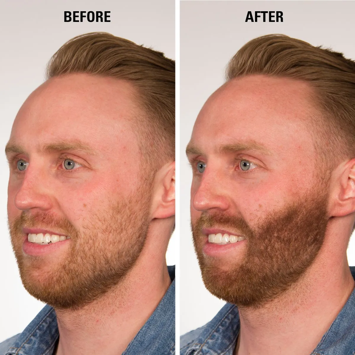 Hair Fiber Medium Brown, Hair Thickening Fiber - Hair Loss Concealer for Men & Women, 28g