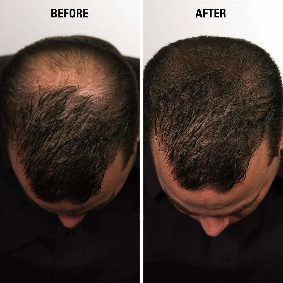Hair Fiber Medium Brown, Hair Thickening Fiber - Hair Loss Concealer for Men & Women, 28g