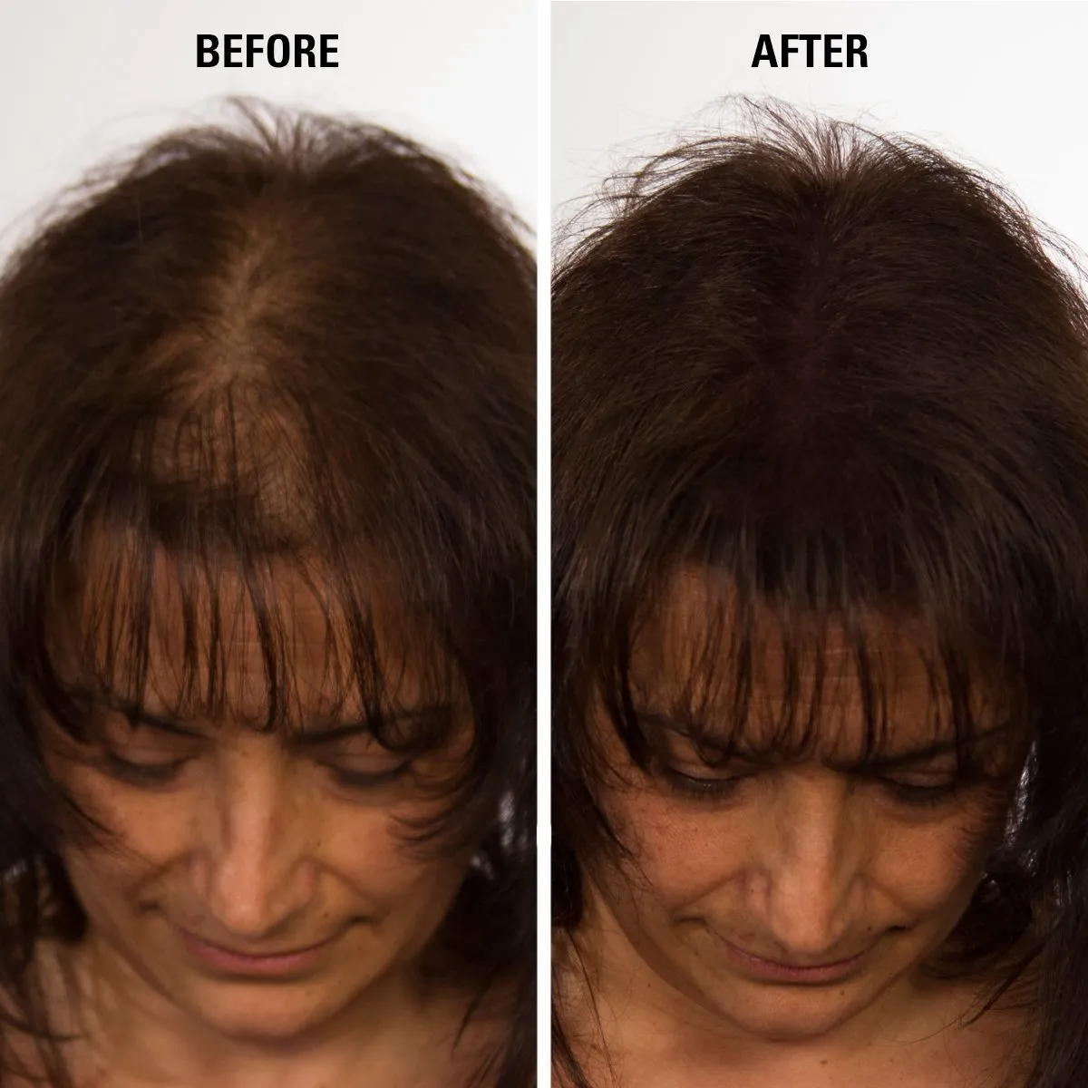 Hair Fiber Medium Brown, Hair Thickening Fiber - Hair Loss Concealer for Men & Women, 28g