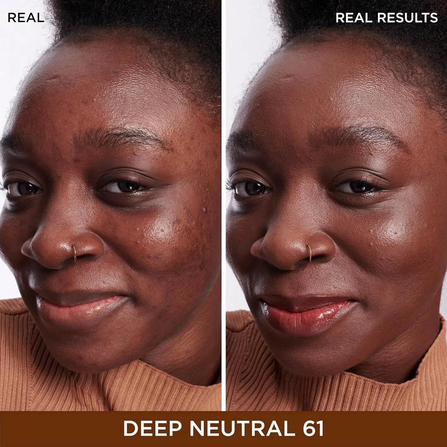 IT Cosmetics Bye Bye Dark Spots Concealer   Brightening Serum – 2% Niacinamide, Hyaluronic Acid & Caffeine - Medium Coverage, Natural Finish, All Skin Types - 0.22 fl oz