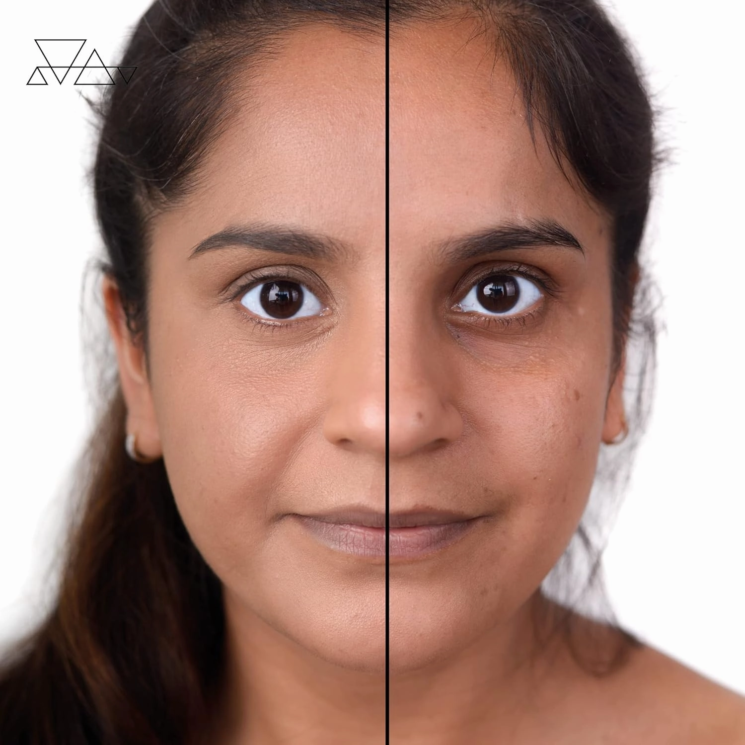 Loves-You-Back 3in1 Mineral Powder Foundation (BEIGE 4) | Designed for acne-prone, sensitive skin | Smooths skin and covers dark circles with Natural Coverage | Vegan   Cruelty Free