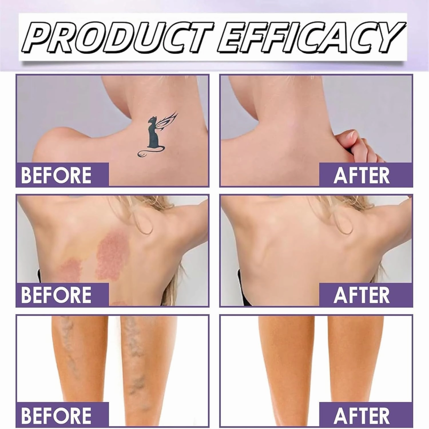 Miracle De Paris Body Coverage Perfector, Miracle De Paris Leg Makeup, All Over Complexion Perfector, Body Coverage Perfectors Waterproof, Long-Lasting Sweat-Proof (#1)