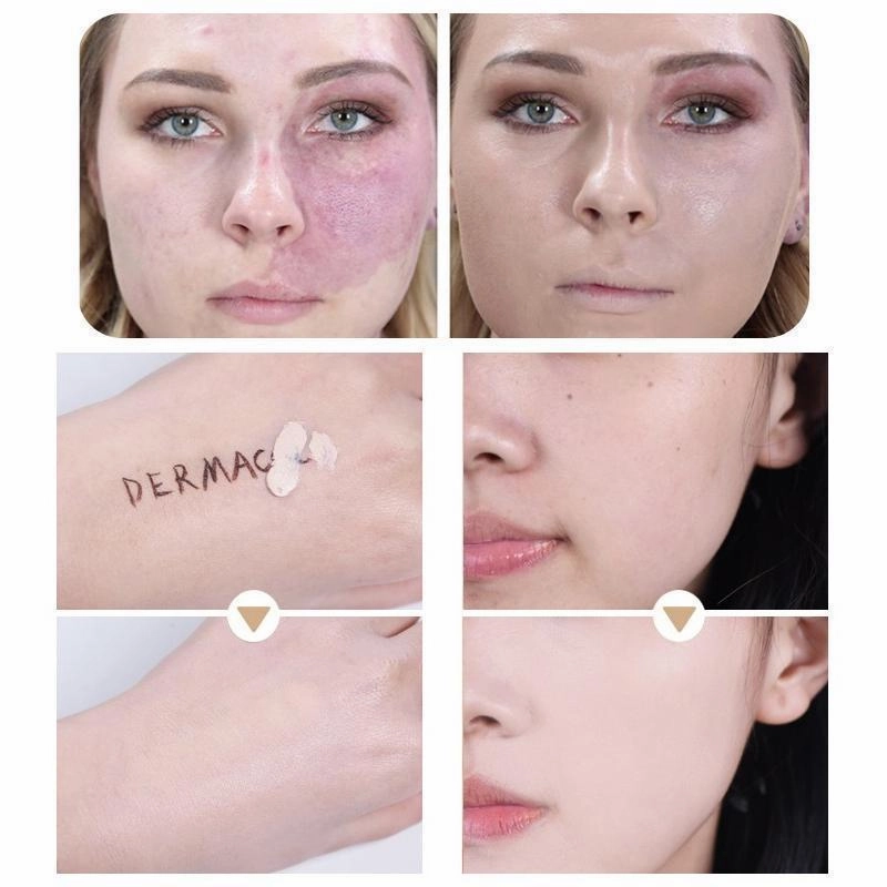 RYNX | Waterproof concealers for facial scars tattoo, 30g, 13 color shades