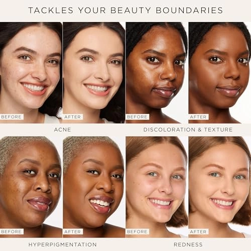 tarte shape tape full-coverage concealer - 38N medium-tan neutral (medium to tan skin with a balance of warm & cool undertones) - full size