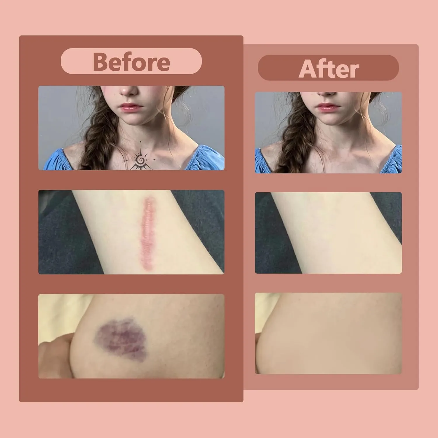 Tattoo Cover Up - 2 Colors Waterproof Makeup Cream, Invisible Skin Concealer Set for Tattoo, Scars, Vitiligo and Dark Spots