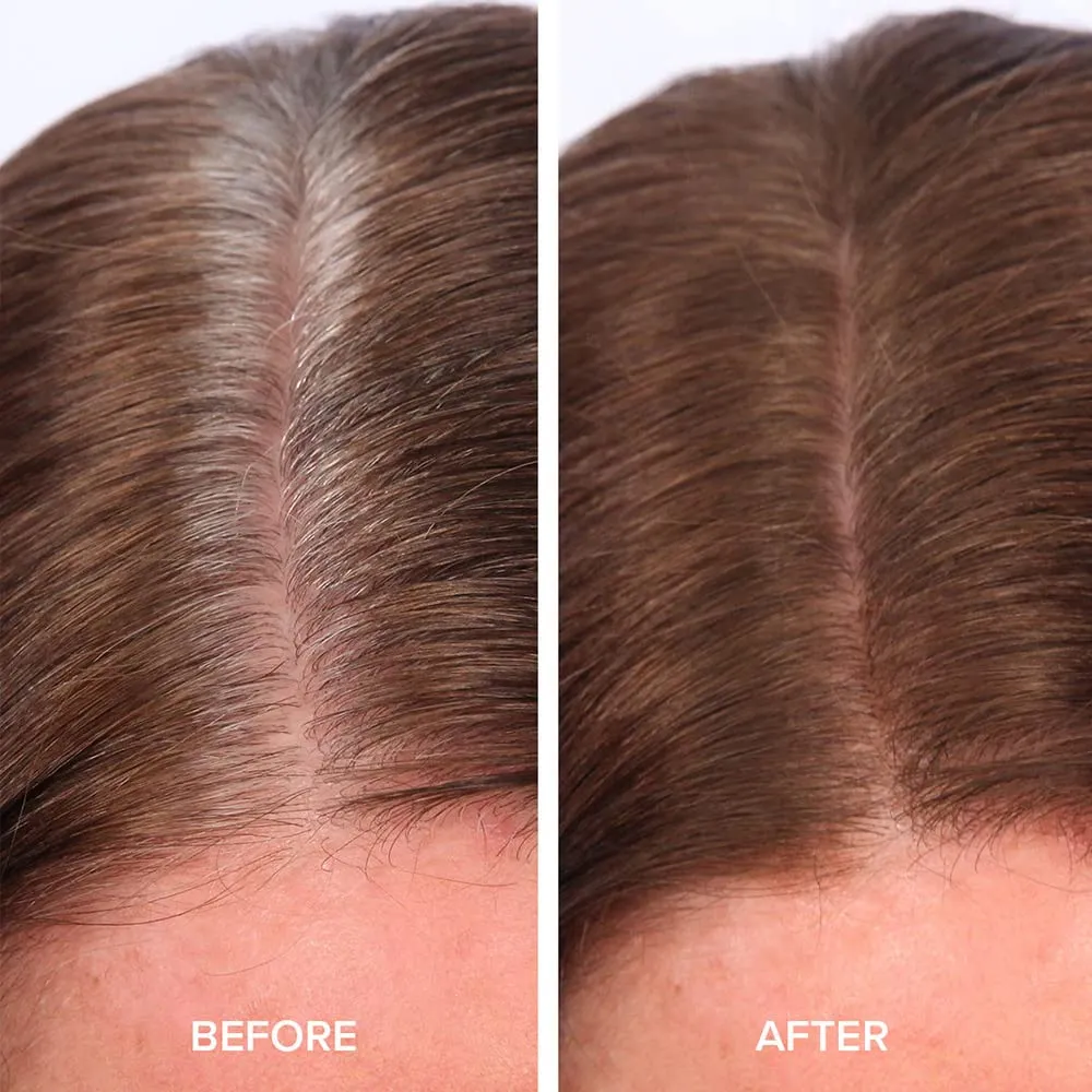 TRUHAIR Color & Conceal Waterproof Root Touch Up Hair Color Concealer - Hair Cover up for Gray Coverage and Hairline Filling - 11 Hair Colors Available (Dark Brown)